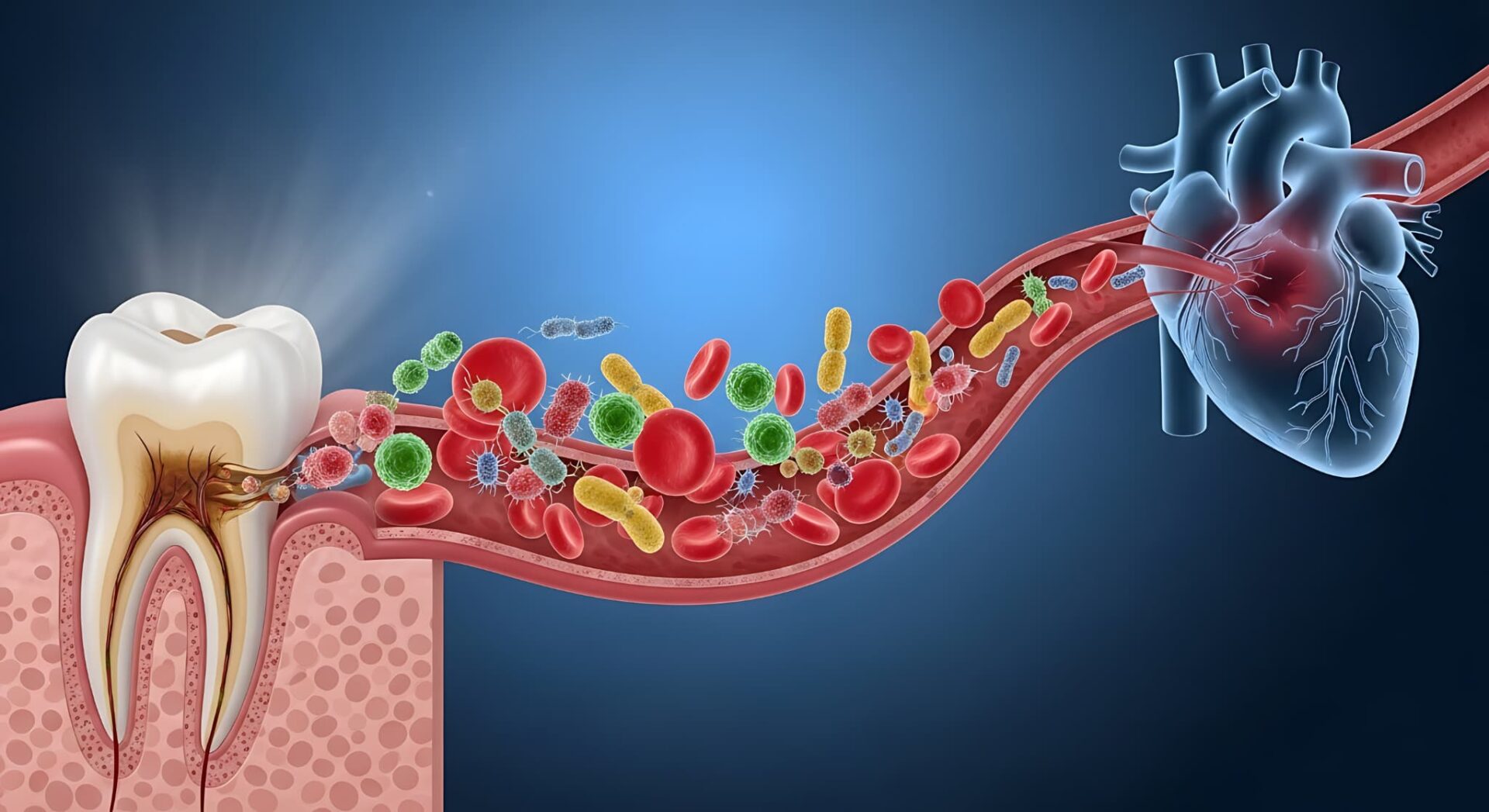 歯周病が引き起こす全身疾患のイメージ