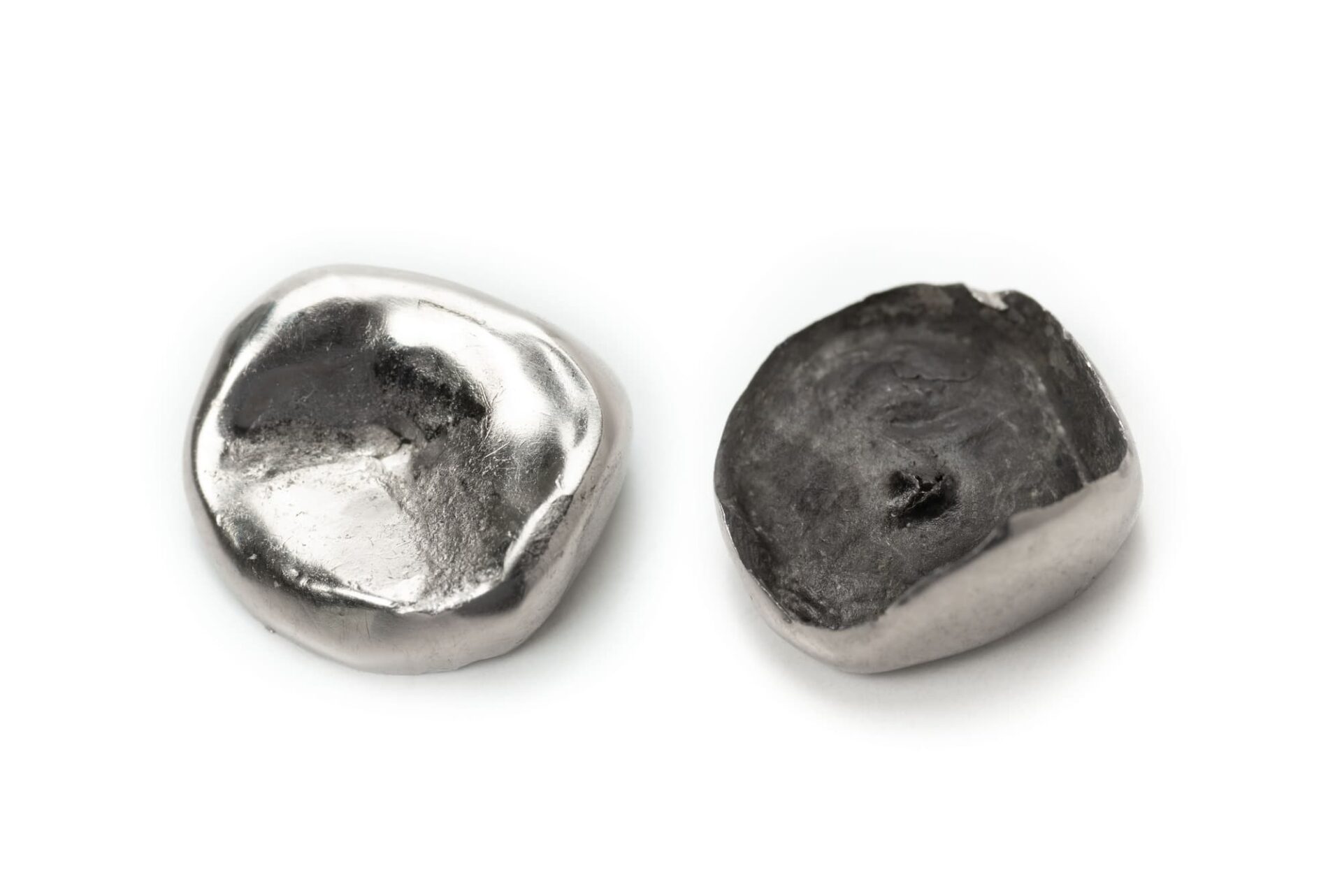 裏側が劣化した銀歯