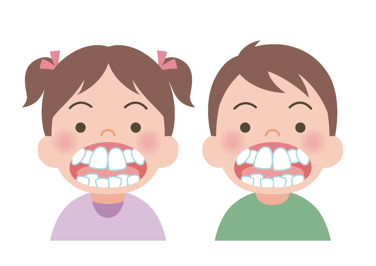 出っ歯の子ども